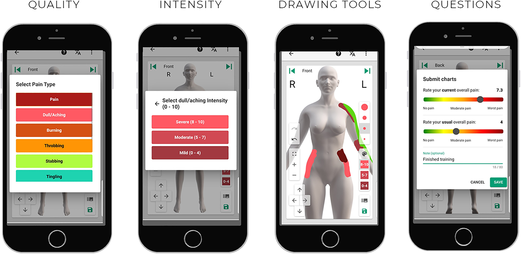Figure 1:
Screenshots from the Navigate Pain software (Aglance Solutions, ApS), as displayed on a mobile device, showing the option to select pain and multiple pain qualities, the intensity of each quality, drawing tools for maneuvering, zooming, and pen size. Before saving, there is an option to record additional questions, such as current and usual pain intensity on a visual analogue scale—screenshots used with permission.