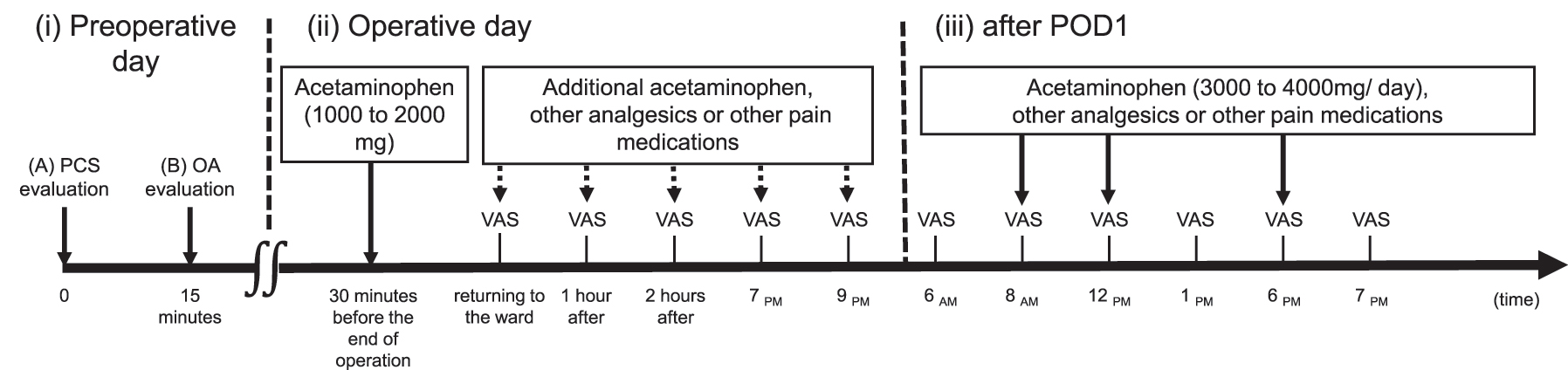 Figure 1: 
              Schematic illustration of the study protocol on (i) preoperative day, (ii) operative day, and (iii) after POD1. (i) Preoperative day: (A) Patients completed PCS evaluation. (B) OA evaluation begins 15 min after the end of PCS evaluation. The thermal stimulus for OA is 32 °C (20 s) at baseline and 46 °C (5 s), 47 °C (5 s), and 46 °C (20 s). (ii) Operative day: during the operation, acetaminophen is administered at doses of 1,000–2,000 mg. Additional acetaminophen, other analgesics, or other pain medications are added based on the POP intensity evaluated using VAS (VAS-POP) (dashed arrows). VAS-POP is assessed immediately, 1 h, and 2 h after returning to the ward; and at 7 pm and 9 pm. (iii) After POD1: following POD1, VAS-POP is assessed at 6 am, 1 pm, and 7 pm. In addition, VAS-POP is assessed at 8 am, 12 pm, and 6 pm during acetaminophen administration. Other analgesics or pain medications are administered if the pain is not well-controlled. The dose of analgesics is adjusted and reduced according to the POP level. POD1, postoperative day 1; PCS, pain catastrophising scale; OA, offset analgesia; POP, postoperative pain; VAS, visual analogue scale.
            