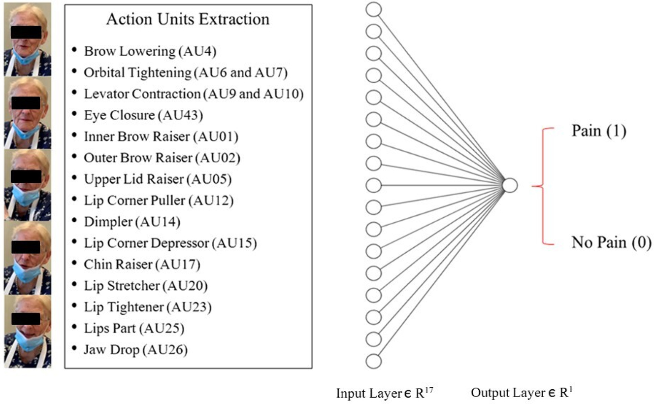 Figure 2: 
            The binary classifier model. The classifier is made up of two dense layers. The first layer consists of 17 nodes associated with the facial Action Units (AUs) extracted by OpenFace for each image. The final layer (i.e., output layer), uses a sigmoid activation function to output a classification label of either “pain” (1) or “no-pain” (0), based on the outputs from the neurons in the previous layer. Patient consent was acquired for the study (ClinicalTrials.gov Identifier: NCT04726228) and scientific divulgation of personal identifiable information.
          