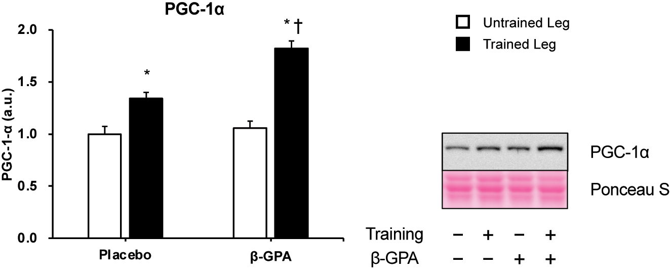Figure 6: 
PGC-1α protein expression in rat skeletal muscle (n=5 in each group). Data was expressed as mean ± SE. *p<0.05 (vs. Untrained leg in the same group). †p<0.05 (vs. Trained leg in control group)
