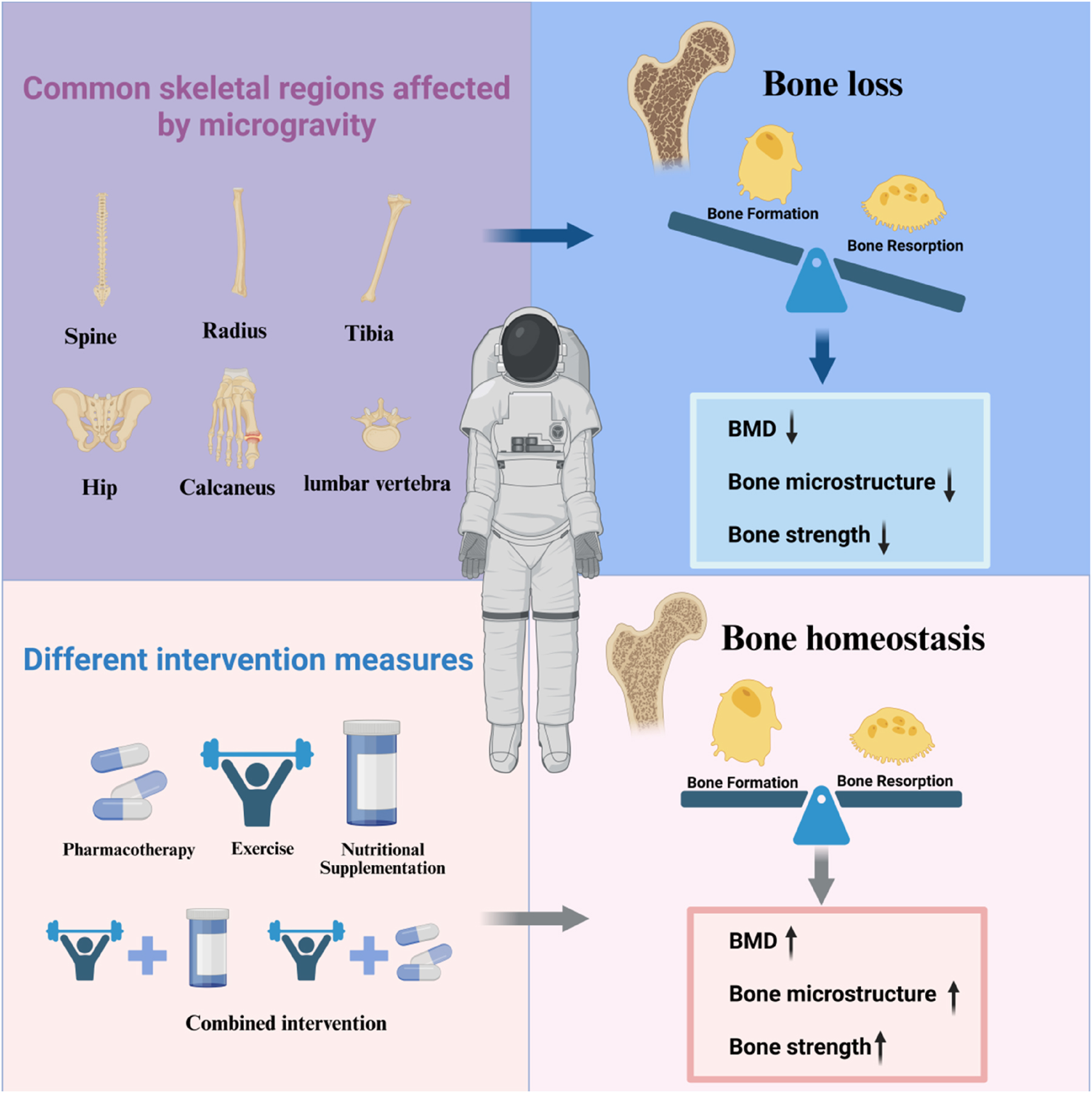 Figure 2: 
Different intervention methods attenuate microgravity-induced bone loss.
