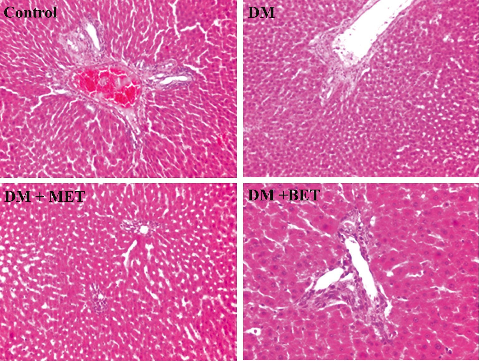 Figure 3: The effect of betaine (BET) and metformin treatments on liver histology in diabetic rats induced by streptozotocin (STZ) (H&E; ×100/×200).