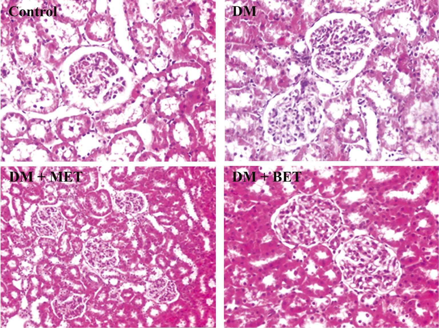 Figure 4: The effect of betaine (BET) and metformin treatments on kidney histology in diabetic rats induced by streptozotocin (STZ) (H&E; ×100/×200).