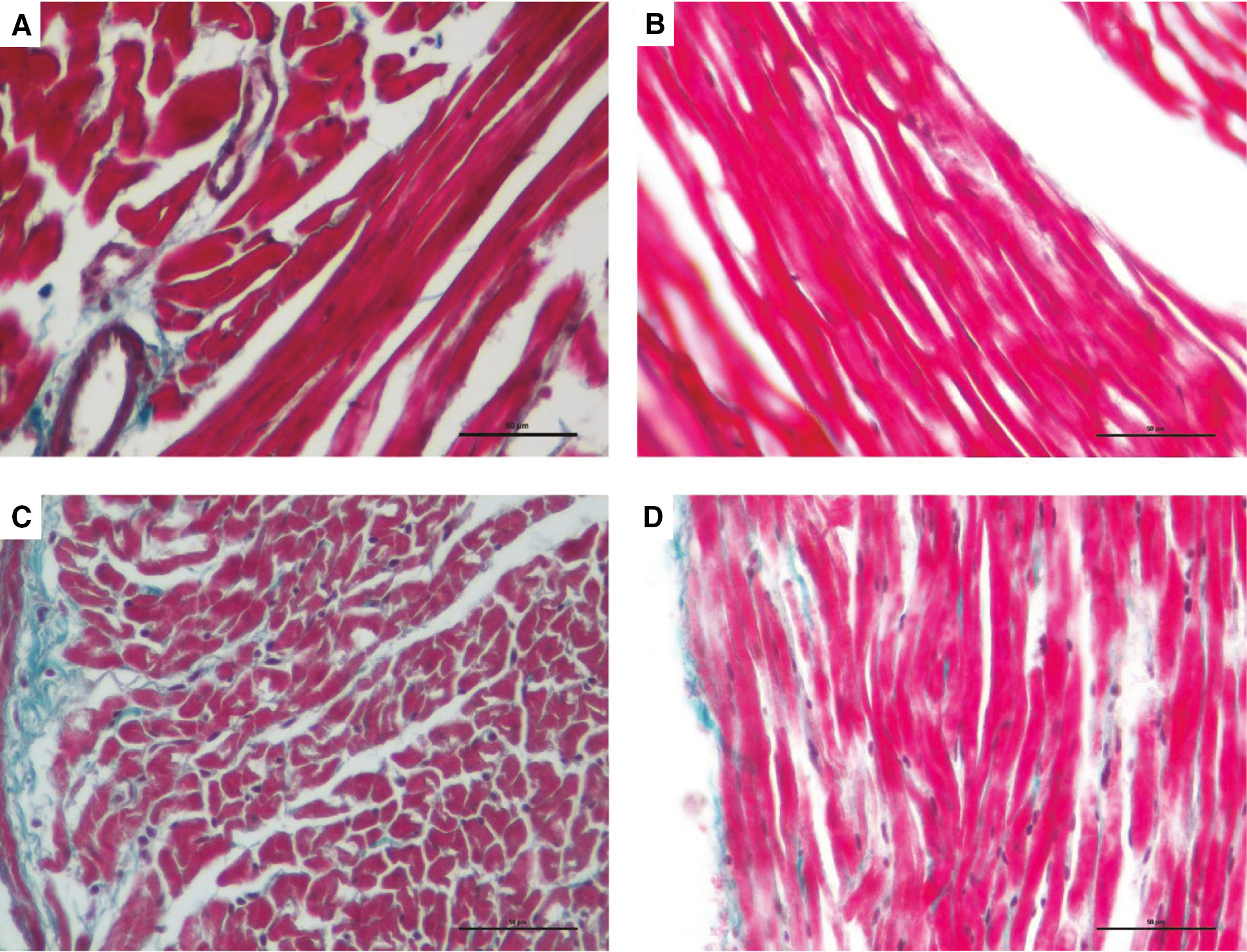 Figure 2: Images of Masson’s trichrome staining from control (A), resveratrol treated control (B), diabetic (C) and resveratrol treated diabetic (D) cardiac sections.Sections of hearts from all groups appear normal (VG, X400, scale bar=50 μm).