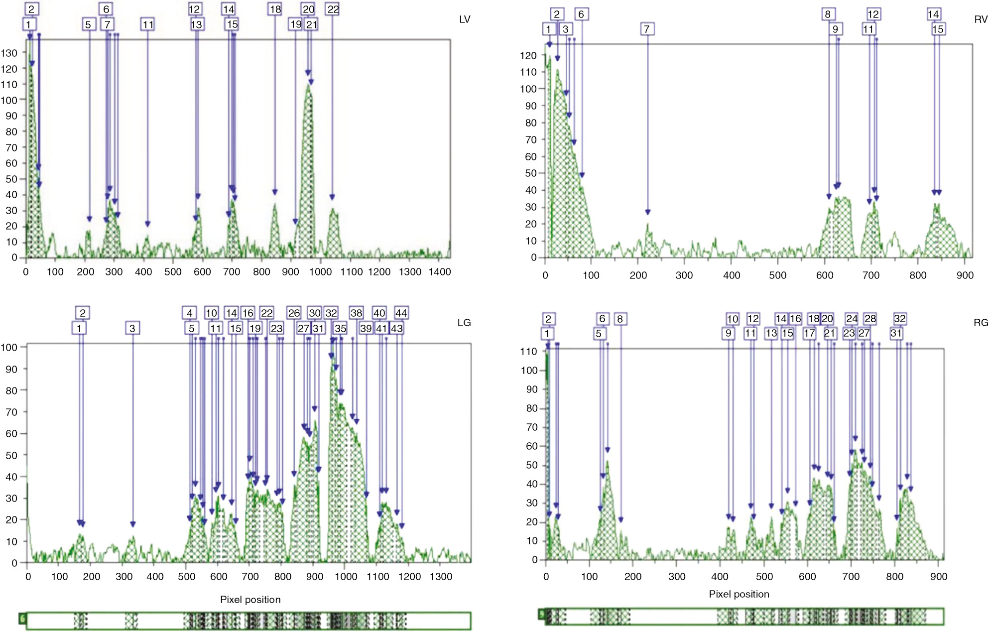 Figure 4: Densiometeric analysis of total protein of F. gummosa Boiss root (R) and leaf (L) at vegetative (V) and generative (G) stages.Digits represent the number of protein, and the area surrounded by each peak shows the concentration of protein.