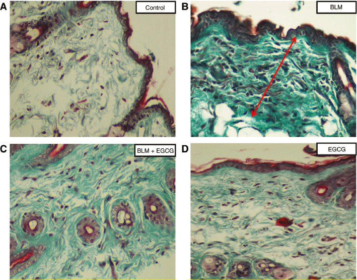Figure 1: Masson-Trichrome staining.Evidence of fibrosis (green color) was more prominent in the BLM group than BLM+EGCG group. Original magnification 20×. (A) Control group, (B) BLM group, (C) BLM+EGCG group, (D) EGCG group.