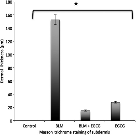 Figure 2: Staining score for Masson trichrome.Results are presented as mean+SEM. *p<0.05.