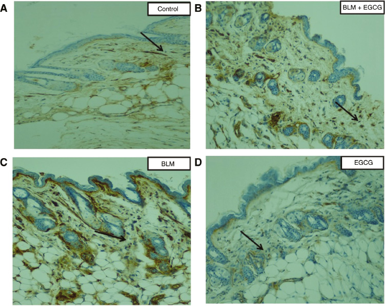 Figure 3: α-SMA staining of dermal tissue sections.Alpha smooth muscle actin (α-SMA) is a marker for activated fibroblasts. The number of α-smooth muscle actin-positive fibroblast cells (black arrows) was higher in the BLM group than BLM+EGCG group. Original magnification 20×.