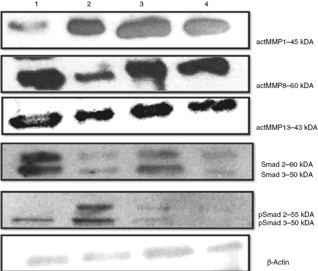 Figure 5: Effects of EGCG treatment on MMPs and Smad pathway proteins in scleroderma.Western blottings were performed to measure protein levels of MMP1, MMP8, MMP13, SMAD 2/3 and pSMAD 2/3, as described under materials and methods. (1) Control group, (2) BLM group, (3) BLM+EGCG group, (4) EGCG group.