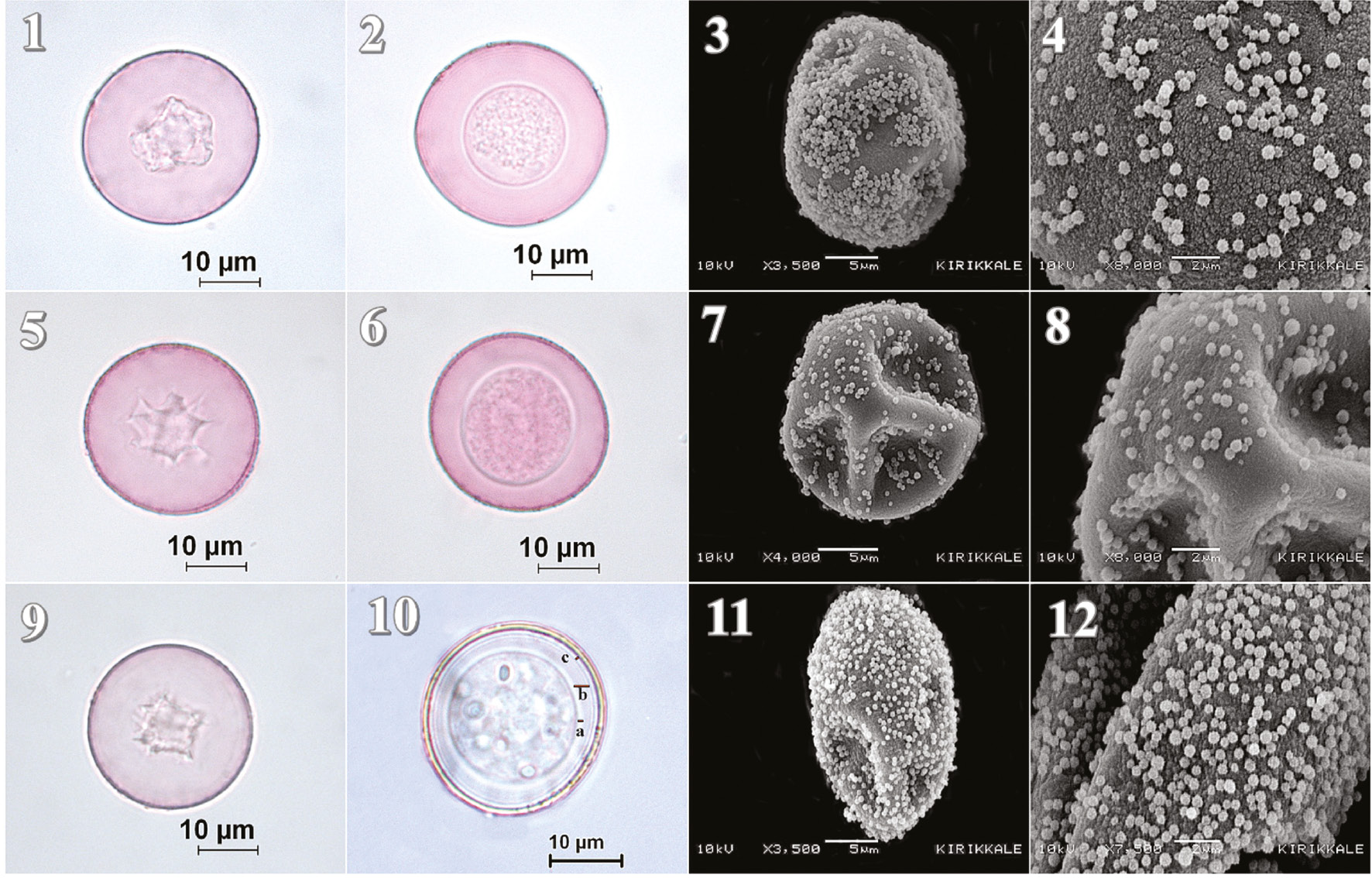 Figure 1: LM and SEM microphotographs of studied taxa. 1–2.LM microphotographs of C. arizonica, 3–4. SEM microphotographs of C. arizonica, 5–6. LM microphotographs of C. sempervirens, 7–8. SEM microphotographs of C. sempervirens. 9–10. LM microphotographs of J. oxycedrus (a:inner intine; b:middle intine; c:outer intine layers), 11–12. SEM microphotographs of J. oxycedrus.