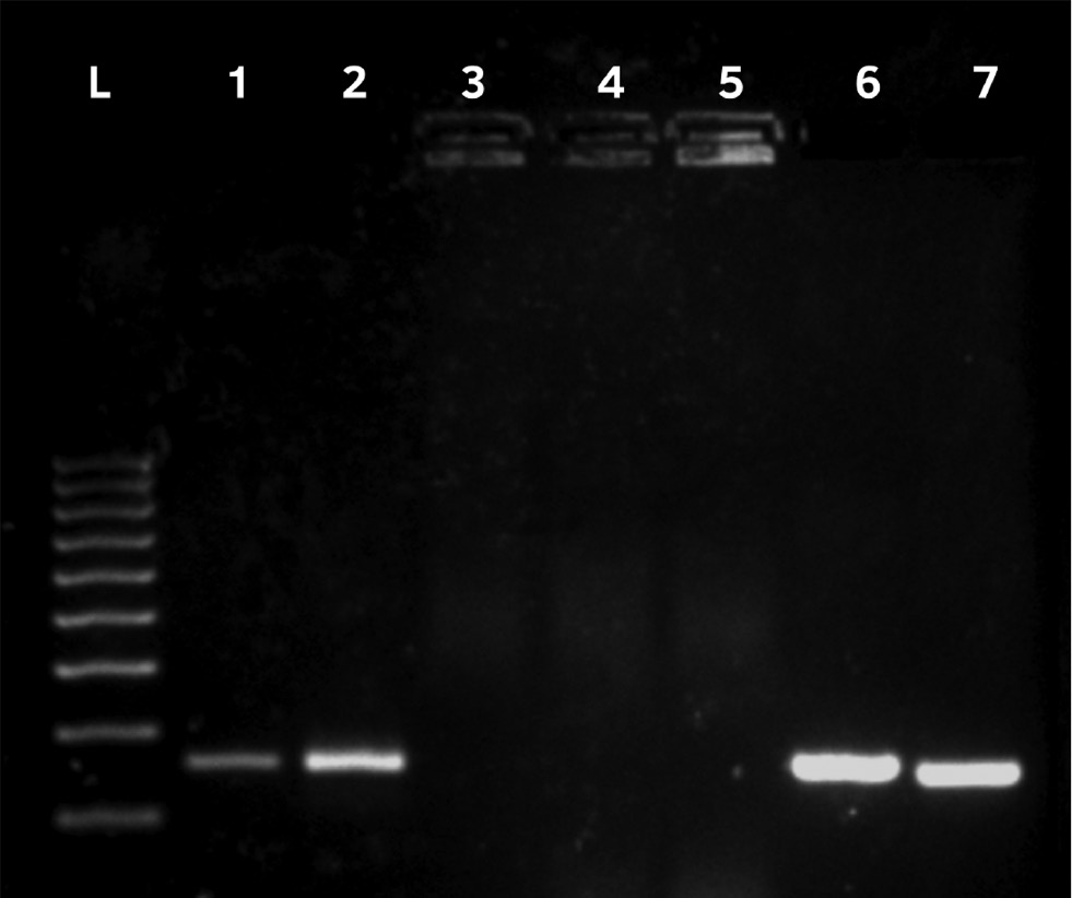 Figure 1: Agarose gel view of the control groups.(L) DNA ladder (100–1000 bp), (1) 13 May sample, (2) 21 May sample, (3) 20 February sample, (4) A. artemisiifolia pollen, (5) B. pendula pollen, (6) S. viridis pollen, (7) P. pratense pollen.