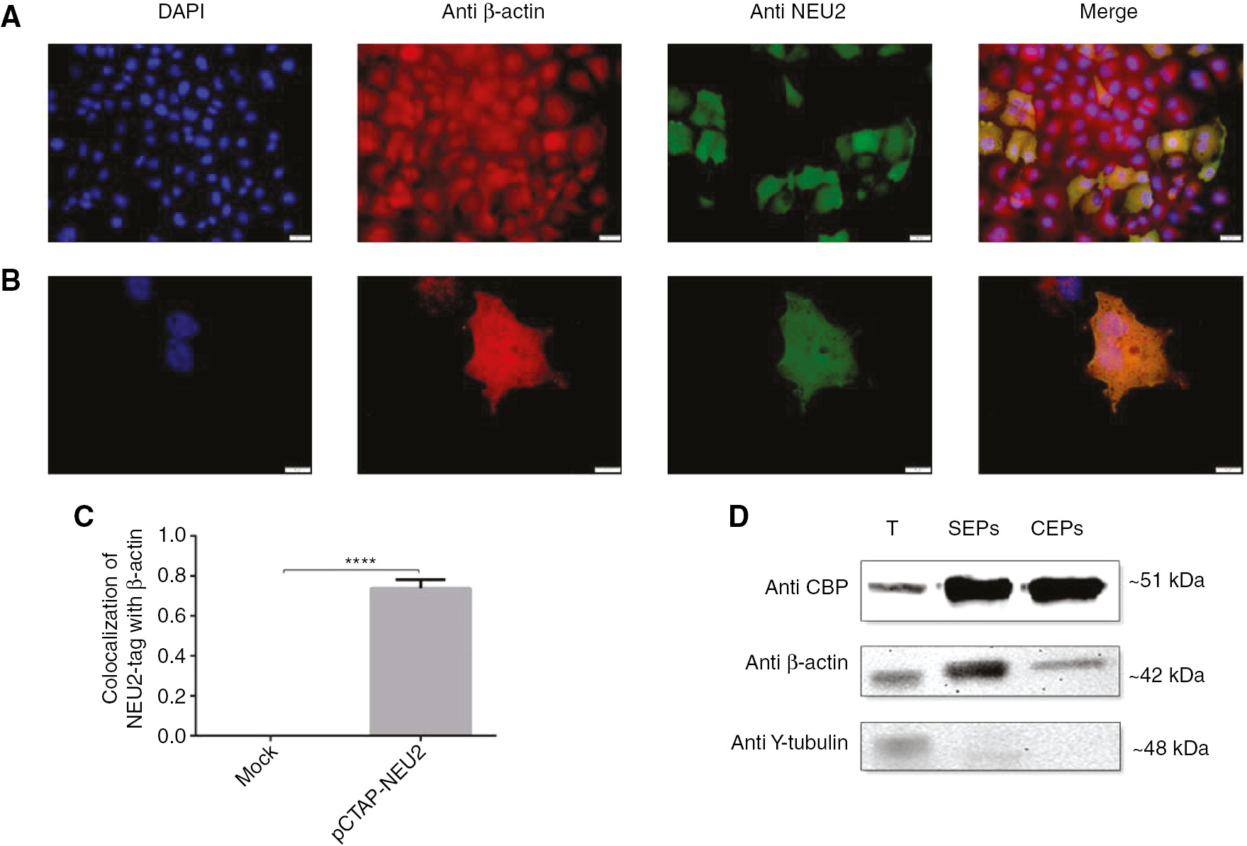 Figure 4: NEU2-tag protein was associated with β-actin in 48-h post transfected COS-7 cells.Double-immunocytochemical staining of cells showed colocalization of NEU2-tag with β-actin. Scale bar, (A) 10 μm and (B) 20 μm. β-Actin protein was visualized in red, NEU2-tag in green, nuclei in blue. A yellow signal signified colocalization of NEU2-tag and β-actin. (C) Colocalization analysis of NEU2-tag with β-actin was determined by using Coloc 2 based on Pearson’s coefficients on Image J (n=10). (D) Western blot analysis of TAP-purified proteins showed that the interaction between NEU2-tag and β-actin was conserved during the step by purification. γ-Tubulin expression served as a negative control. Molecular weights of NEU2-tag, β-actin, and γ-tubulin were 51 kDa, 42 kDa, and 48 kDa, respectively. T, Total proteins isolated from the COS-7 cell at 48 h after transfection with pCTAP-NEU2; SEP(s), proteins obtained at the streptavidin elution step; CEP(s), proteins obtained at the calmodulin elution step. The data are represented as the mean±SEM. The unpaired t-test was used for statistical analysis (****p<0.0001).