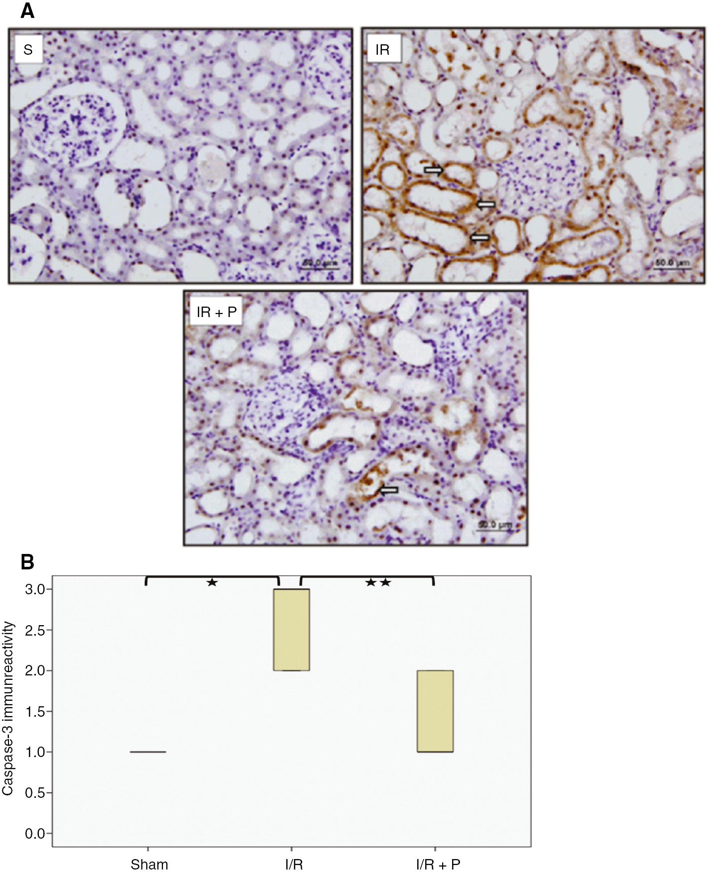 Figure 4: Effect of paricalcitol pretreatment on I/R induced tubular cell apoptosis.Representative light-microscopic images of the active caspase-3 immunoreactivity in kidneys. Arrows () indicate anti-active caspase-3 immunopositive cells (A). Box-plot representing the percent area of active caspase-3 immunopositive cells which were compared among study groups (B). S, sham (n=6); I/R, 45 min ischemia followed by 24 h reperfusion (n=7); I/R+P, paricalcitol administration (0.3 μg/kg) 24 h before I/R (n=7). *p<0.05 vs. S; **p<0.05 vs. I/R, Mann-Whitney U-test.