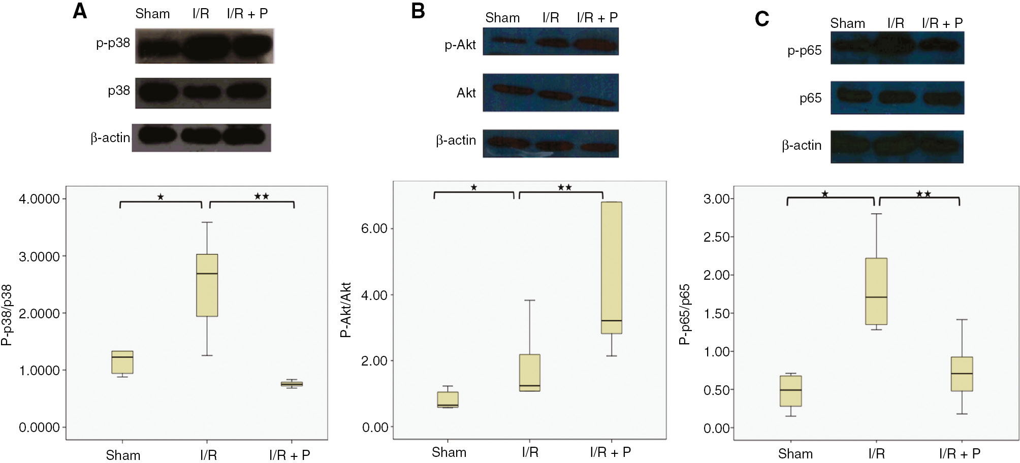 Figure 6: Effects of paricalcitol pretreatment on p38 MAPK, PI3K/Akt signaling and NFκB activation during renal I/R.Western blot analysis was used for the protein expressions of p-p38, total p38 MAPK (A), pAkt, total Akt (B) NFκB p-p65 and total NFκB p65 in kidneys (C). β actin was used for normalization. Box-plot representing semi-quantitative analysis of protein expressions which were compared among study groups. S, sham (n=6); I/R, 45 min ischemia followed by 24 h reperfusion (n=7); I/R+P, paricalcitol administration (0.3 μg/kg) 24 h before I/R (n=7). *p<0.05 vs. S; **p<0.05 vs. I/R, Mann-Whitney U-test.