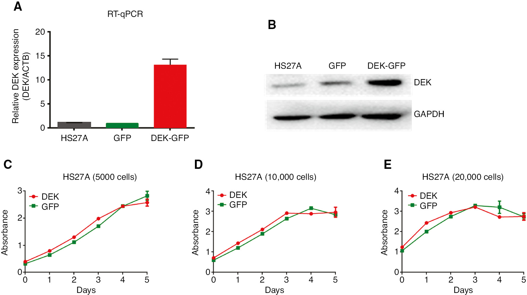 Figure 1: Analysis of proliferation of the HS27A cell lines that stably overexpress DEK.(A) RNA and cDNA was prepared from the FACS-sorted GFPpositive cells and the overexpression of DEK in these cell lines was confirmed by using RT-qPCR as described in the text. (B) Cell lysates from the FACS-sorted GFPpositive cells were prepared and they were used in the Western blot analysis to confirm the overexpression of DEK as described in the methods. Figures in the (A) and (B) shows the expression level of DEK in the HS27A cells (Parental cells), HS27A-GFP cells (Control cells that are stably transduced by MIG retrovirus), and HS27A-DEK-GFP cells (Cells that are stably transduced by MIG-DEK-GFP retrovirus). (C–E) Growth curves show the proliferation of the HS27A-GFP (GFP; green lines) and HS27A-DEK-GFP (DEK; red lines) cells that are cultured in the growth medium at a concentration of 5000 cells/well (C) 10,000 cells/well (D) and 20,000 cells/well (E) of the 96 well plates in triplicate. Proliferation rate of the cells was analyzed by using WST-1 assay for five consecutive days. Error bars in each figure indicate ±SEM. Figures show one representative results of the minimum two independent experiments.