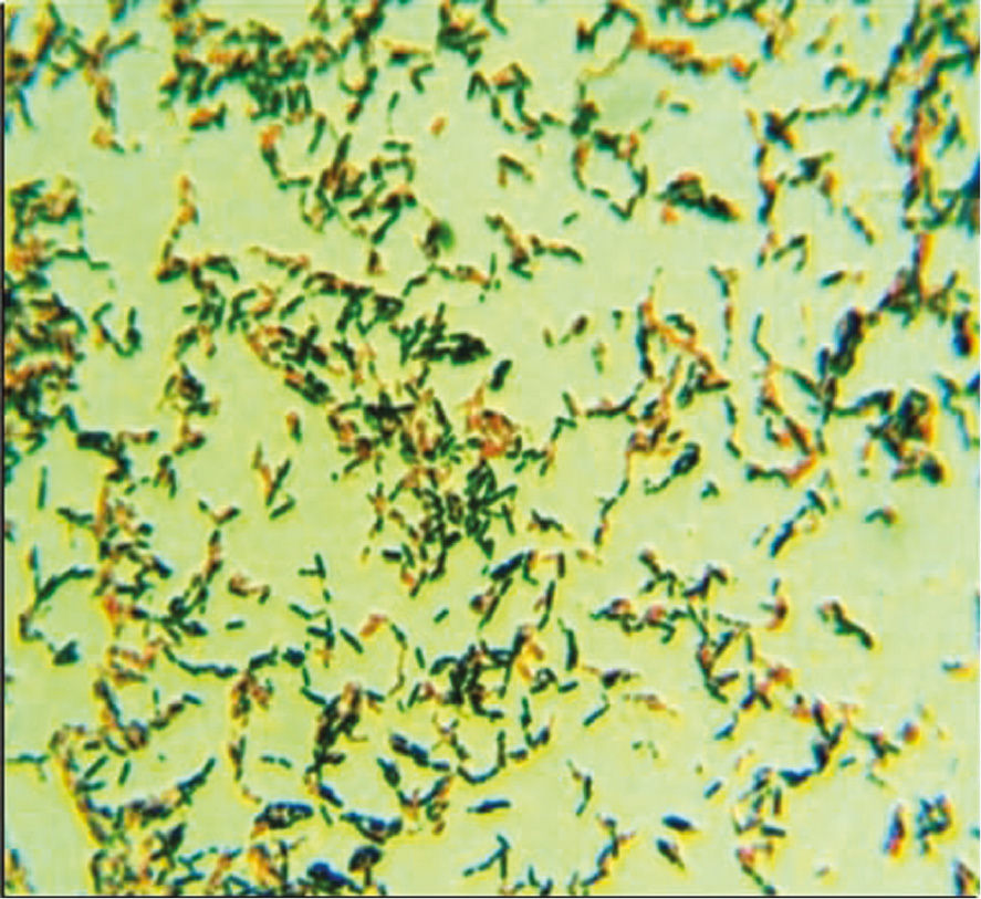 Figure 1: Positive bacterial colonies showing intracellular PHB granules (bluish-black) stained with Sudan black B dye.
