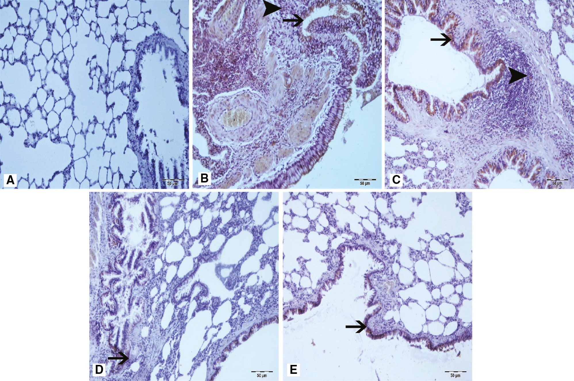 Figure 2: Staining of samples with LC3B.(A) Sham group, (B) arrow at bronchial epithelium and arrowhead at peribronchial areas of Group 3, (C) arrow at bronchial epithelium and arrowhead at peribronchial areas with severe LC3B immunopositivity of IR groups (Group 2 and 3), (D) arrow at bronchial epithelium of Group 4, (E) arrow at bronchial epithelium with mild LC3B immunopositivity of Group 5. IHC.