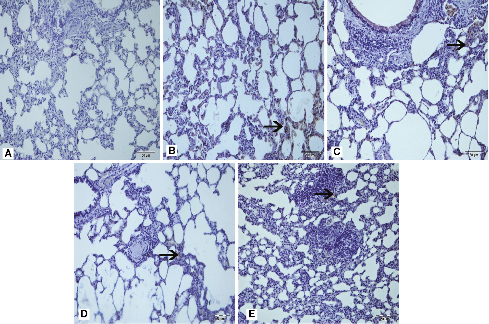 Figure 3: Staining of samples with NF-κB.(A) Sham group, (B) arrow at interstitial areas of Group 3, (C) arrow at interstitial areas with moderate NF-κB immunopositivity of IR groups (Group 2 and 3), (D) arrow at interstitial areas of Group 4, (E) arrow at interstitial areas with mild NF-κB immunopositivity (arrowhead) of Group 5. IHC.