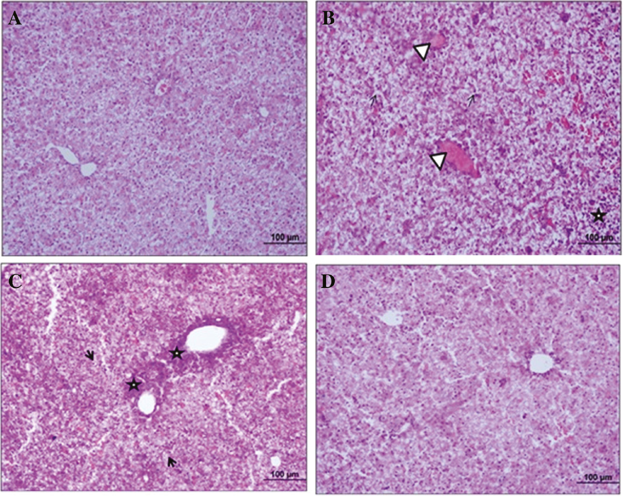 Figure 1: Images of histological analysis of neonate rat’s liver tissue.This sections shows control (A), APAP (B and C) and APAP+betaine (D) groups histology of neonate’s liver (H&E, scale bar: 100 μm, ×20). →, Shows intensive degeneration areas; Δ, congestion in central vein; *, cellular infiltration in perivascular and parenchymal areas.