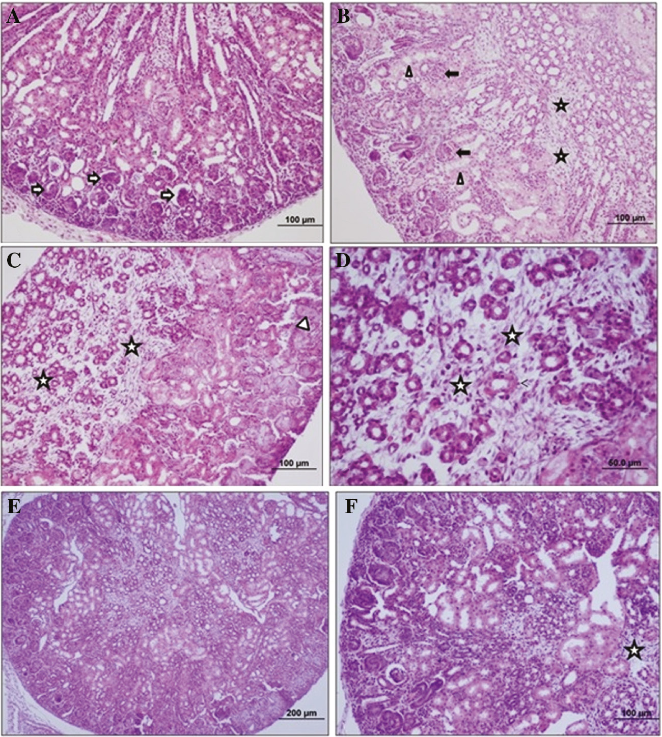Figure 2: Images of histological analysis of neonate rat’s kidney tissue.This kidney tissue sections shows control (A), APAP (B–D) and APAP+betaine (E and F) groups histology of neonates (H&E, scale bar: 60, 100, 200 μm, ×20). →, Shows narrowing in the range of Bowman; Δ, necrotic tubular structure; *, interstitial fibrosis.