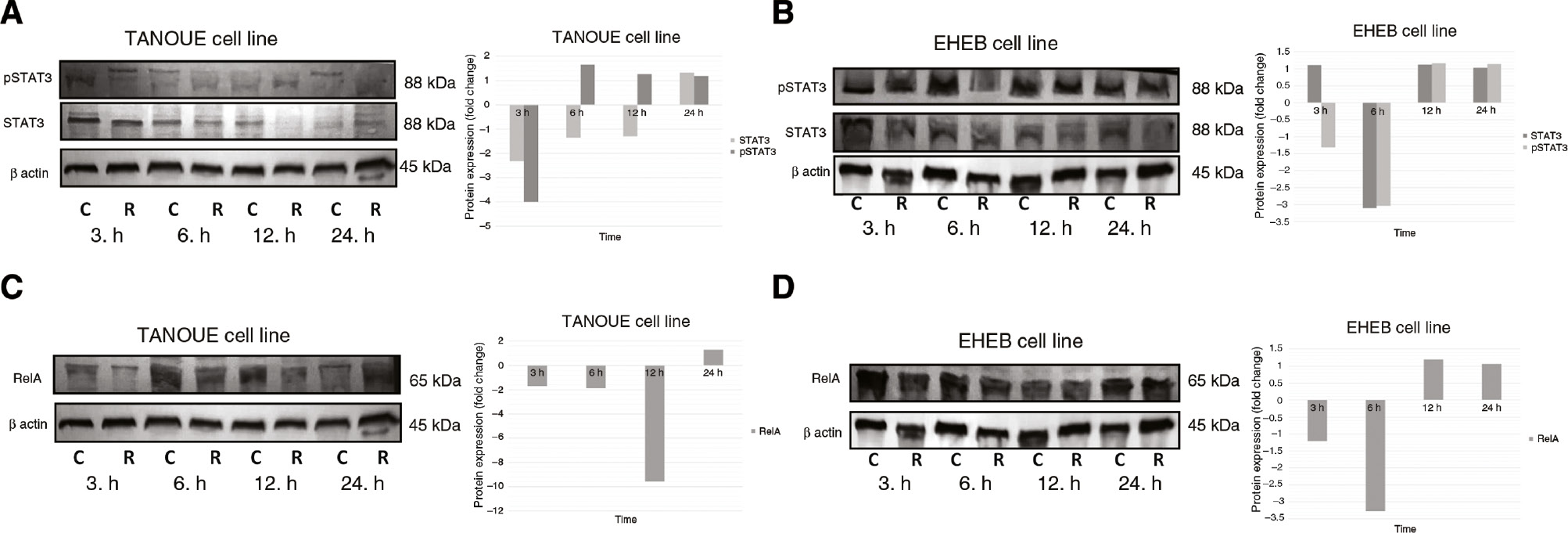 Figure 4: Protein expression analysis of STAT3 and RelA.STAT3 protein expression in (A) TANOUE and (B) EHEB cell lines. RelA protein expression in (C) TANOUE cell line and (D) EHEB cell lines. The indicated cell lines were incubated with Rituximab (20 μg/mL) for 3, 6, 12 and 24 h. Proteins (25–30 μg) were separated by 8% SDS-PAGE and transferred to PVDF membranes. Protein levels were detected by using the chromogenic alkaline phosphatase assay. Fold changes were analyzed according to the differences between the control and study groups for each time point. Assays were set up in triplicates. Image J and Statistical Package for the Social Sciences (SPSS) 15.0 software were used for analysis. Wilcoxon Signed Rank Test was used to test the significance among these groups. p<0.05 was considered as significant. C: control group; R: Rituximab treated study group.