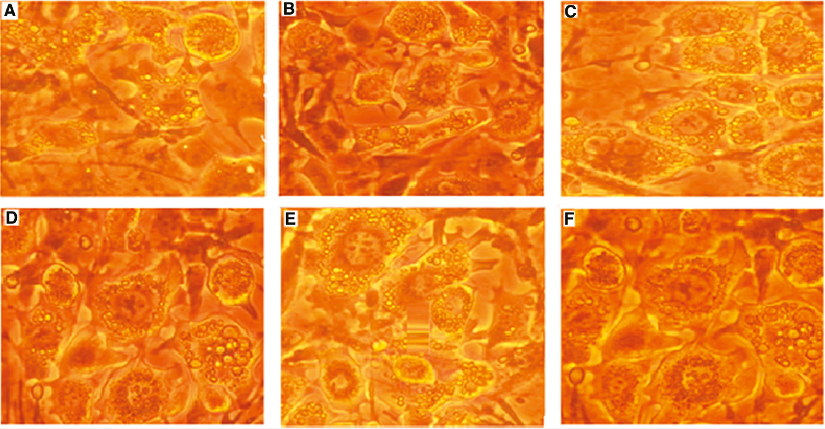 Figure 3:
After differentiation and TPM treatment, photomicrographs of the effect of different concentrations of TPM on the differentiation of 3T3-L1 cells were determined with Oil Red O staining.
(A) 0 μM, (B) 1 μM, (C) 5 μM, (D) 10 μM, (E) 50 μM, (F) 100 μM (10×, Nikon Eclipse TS100).