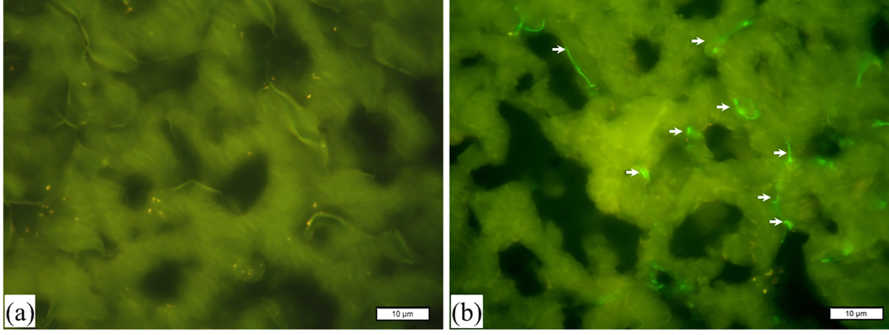 Figure 2: Fluorescence microphotographs of cryosections. Control samples of porcine cardiac tissue are shown in (a) without staining. Cardiac muscle tissue samples, incubated in the presence of DTx–FITC (15 nM) for 2 h, are shown in (b). Localizations of whole toxin (green) are indicated with arrows. Magnification, ×100.