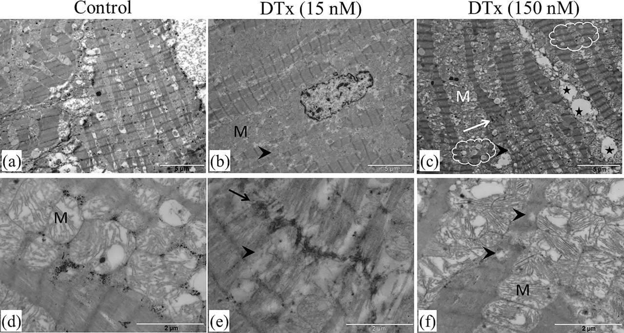 Figure 3: Ultrastructure of porcine cardiac tissue samples. Electron micrographs showing control tissue samples incubated in medium for 2 h (a, d). Tissue sections incubated in the presence of DTx (15 nM) display myofibrillar disruption (arrowhead) and intercalated discs disorganization (arrow), respectively, in (b) and (e). Accumulation of mitochondria around dilated myofibrils is detected (b). Tissue sections incubated in the presence of DTx (150 nM) have a higher degree of disorganization (c, f). Vacuolization (stars), myofibrillar disarray (arrow) and numerous lipid droplets (clouds) are prominent (c). The aggravated mitochondrial degeneration is also found (f). M, mitochondria. Scale bar: 5 μm (a, b, and c); 2 μm (d, e, and f).