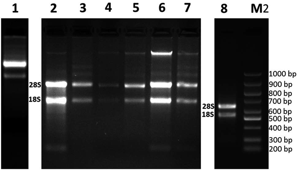 Figure 2: Total RNAs isolated by using different methods. M2: DNA Marker (Bio Basic, 100–1,000 bp). Total RNAs isolated with the use of GeneAll Ribonuclear Plus kit (1), The combined GeneAll Ribonuclear Plus kit and CTAB application (2), Trizol treatment (3), Qiagen RNeasy plant mini kit (4), with the combined use of CTAB treatment and Qiagen RNeasy plant mini kit (5), with the combination of CTAB and spermidine treatments (6), CTAB II protocol (7), with the combined use of CTAB treatment, Phase Lock Gel Heavy column and Qiagen RNeasy plant mini kit (8).