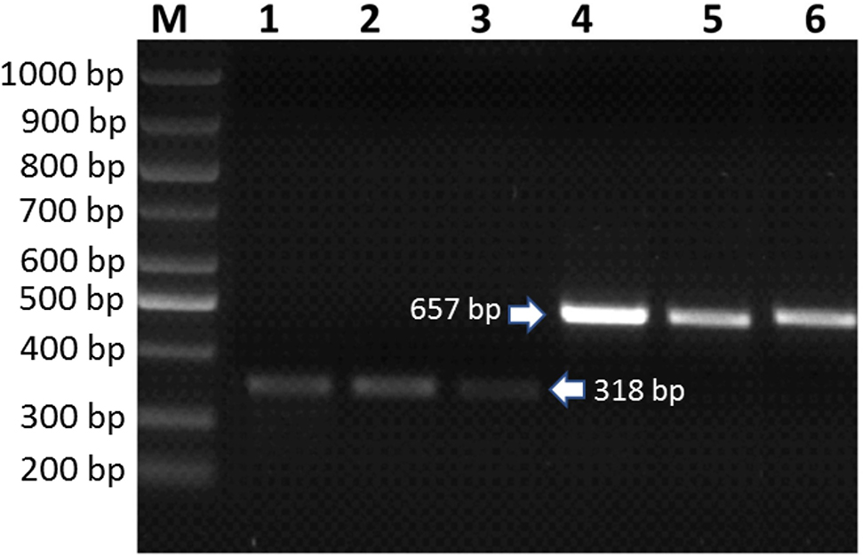 Figure 4: Amplification of Corylus avellana GGPPS and 2S albumin genes by RT-PCR in each genotype using the isolated RNAs as template. M: DNA Ladder (Bio Basic, 100–1,000 bp), Corylus avellana 2S albumin gene amplicon in Çakıldak (1), Tombul (2) and Palaz (3), Corylus avellana GGPPS gene amplicon in Çakıldak (4), Tombul (5) and Palaz (6).
