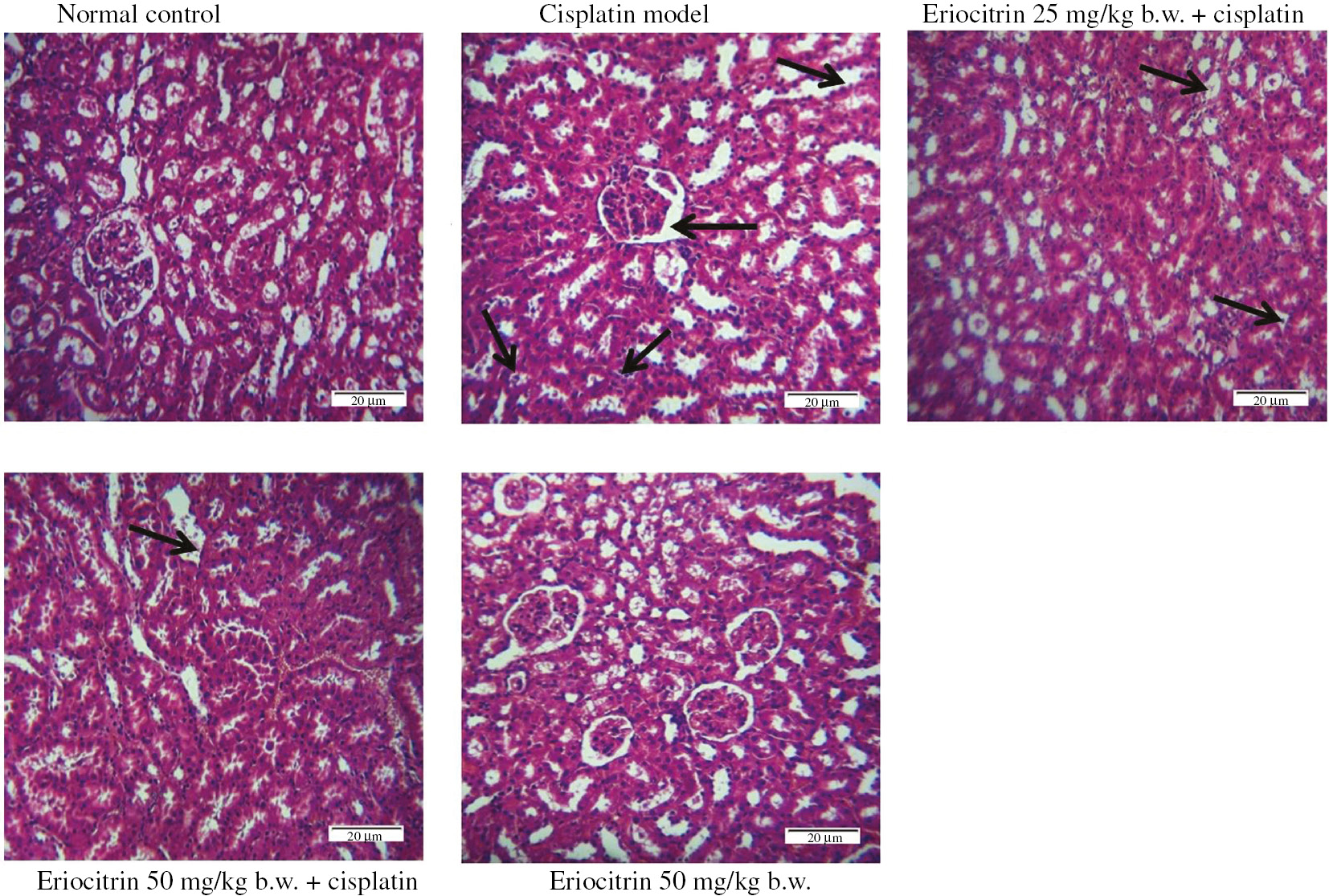 Figure 1: Histopathological changes in kidney due to administration of eriocitrin against cisplatin-induced nephrotoxic rat model.Normal control group and eriocitrin control group demonstrate common renal architecture; Cisplatin-induced nephrotoxic model group show signs of cell atrophy, dilated tubules and loss of boundary in endothelial cells (changes indicated by black arrow); Eriocitrin treated groups show protective features on the renal morphology against cisplatin-induced toxicity with mild loss of boundary (changes indicated by black arrow). H&E at 100× magnification.