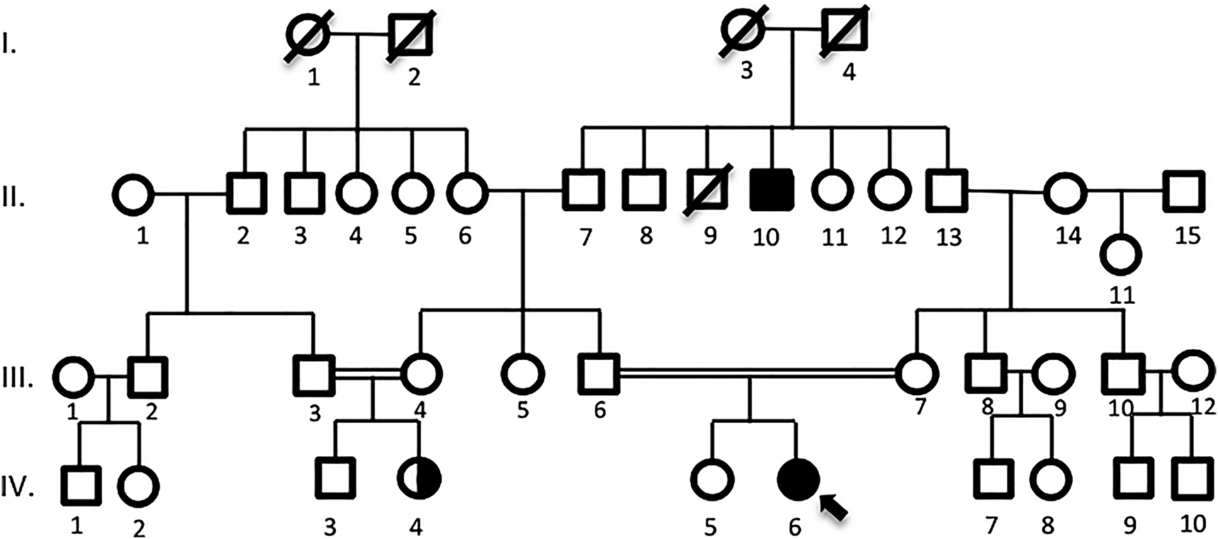 Figure 1: Pedigree analysis of the proband (IV-6) is shown above, who was born to a consanguineous marriage. Her cousin (IV-6) was diagnosed with epilepsy and her older uncle (II-10) was diagnosed with M. Gravis.