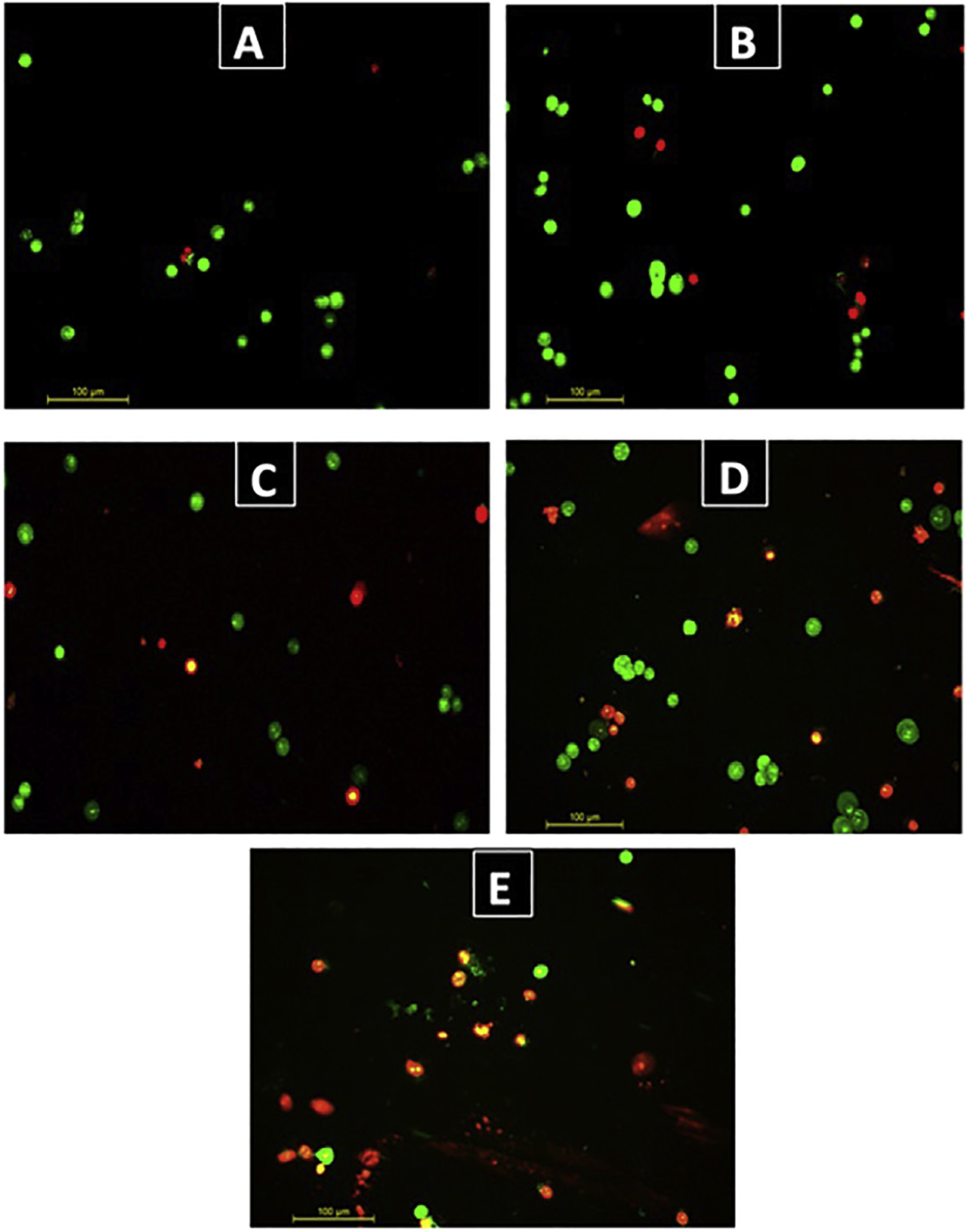Figure 9: Acridine orange/ethidium bromide staining has shown a decreased apoptosis induced by stress in Lovo cell line treated with V. opulus methanol extract. (A) Control without V. opulus treatment. (B) Treatment with 10 μg/mL V. opulus methanol extract. (C) Treatment with 50 μg/mL V. opulus methanol extract. (D) Treatment with 100 μg/mL V. opulus methanol extract. (E) Treatment with 200 μg/mL V. opulus methanol extract under fluorescence microscope by 200X. Green color shows the normal morphology of living cells. It shows apoptosis in yellow and orange cells.