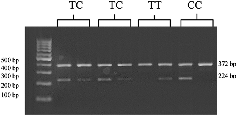 Figure 1: Agarose gel electrophoresis of the genotypes. Lane 2, 3, 4, and 5 show heterozygous TC individuals. Lanes 6–7 and 8–9 shows homozygous individuals for TT and CC genotypes, respectively. The DNA size marker is in lane 1