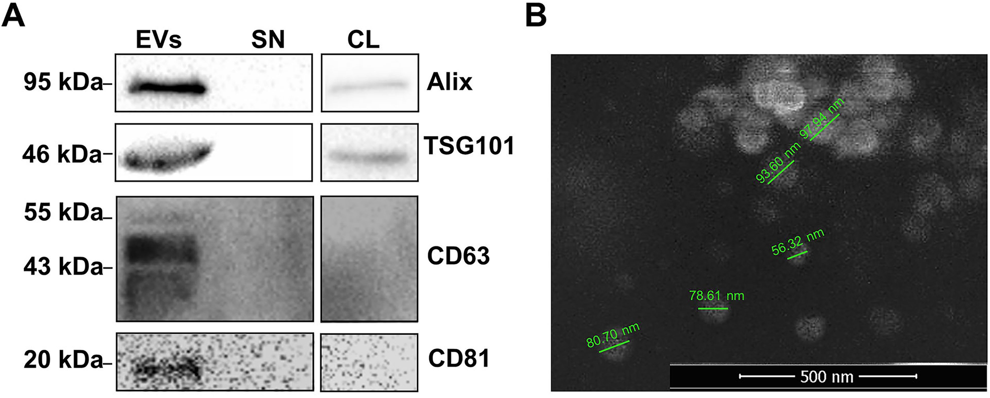 Figure 3: 
Identification of EVs released from U87MG by Western blotting and SEM imaging. A) Western blot analysis demonstrated expressions of EV marker proteins in extracellular vesicles released from glioblastoma cells. B) The characterization of EVs were performed using Scanning electron microscope (SEM). Original magnification ×50,000. The bar 500 nm. Extracellular vesicles (EVs), Supernatant (SN), Cell Lysate (CL).