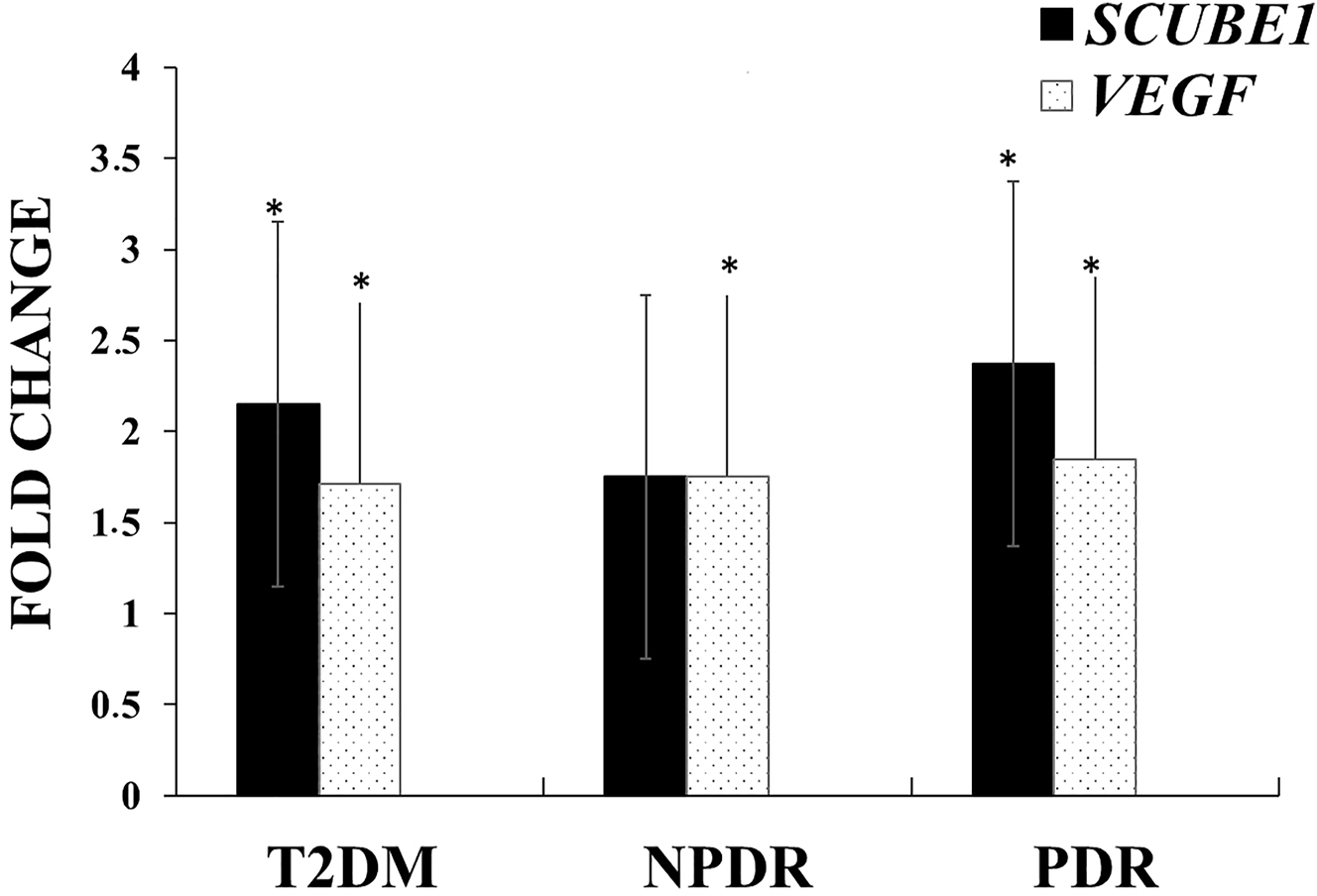 Figure 1:
Comparison of SCUBE1 and VEGF gene expression levels in non-DR, NPDR, and PDR groups compared to the control group. *p<0.05.