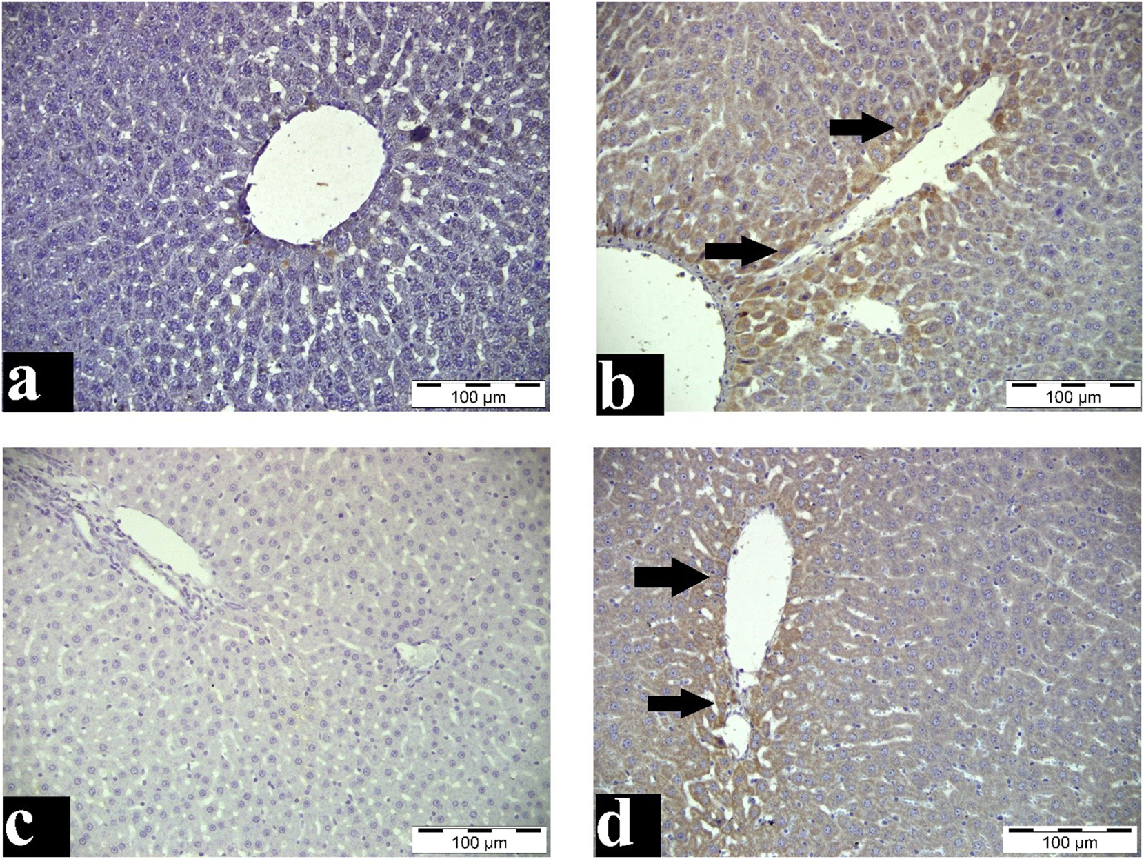 Figure 4:
Bax and Bcl-2 immunoreactivity staining of the liver. a: Control group, liver tissue, IHC, Bar=100 μm b: Paracetamol group, liver tissue, Bcl-2-positive immunoreaction in hepatocytes (arrows), IHC, Bar=100 μm c: Control group, liver tissue, IHC, Bar=100 μm d: Paracetamol group, liver tissue, Bax-positive immunoreaction in hepatocytes (arrows), IHC, Bar=100 μm.