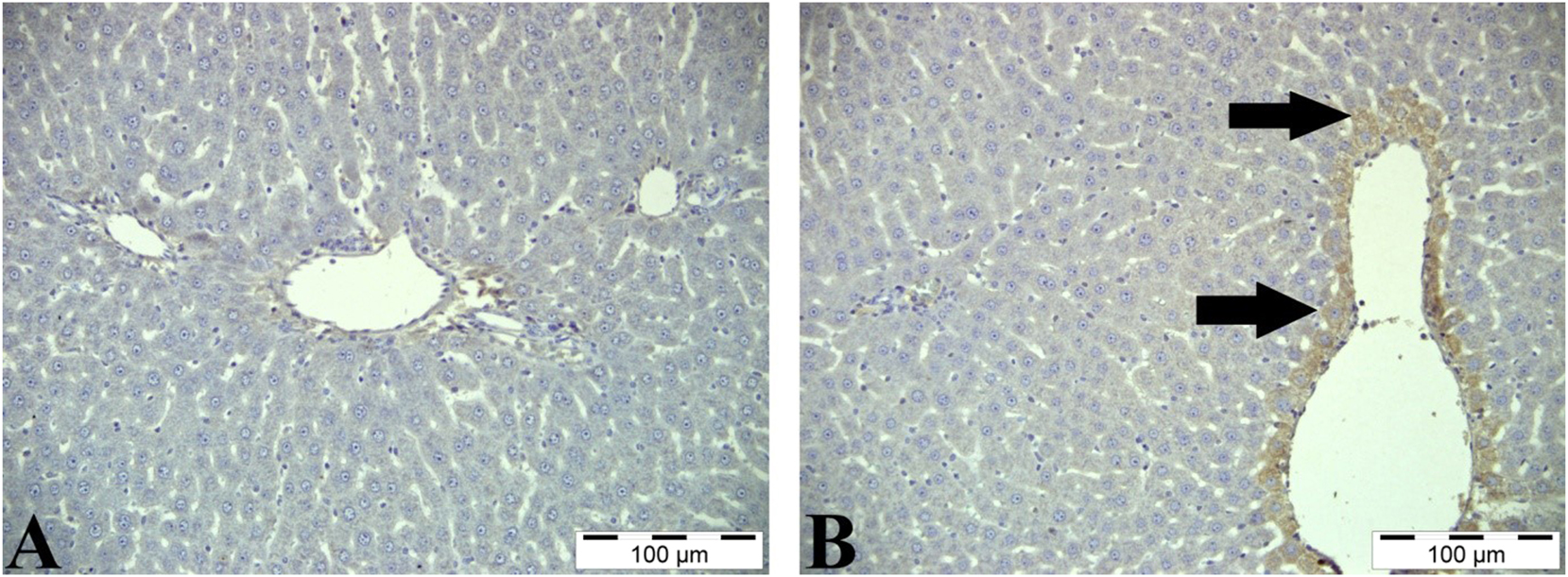 Figure 5:
iNOS immunoreactivity staining of the liver. A: Control group, liver tissue, IHC, Bar=100 μm B: Paracetamol group, liver tissue, positive expression of iNOS in hepatocytes (arrows), IHC, Bar=100 μm.