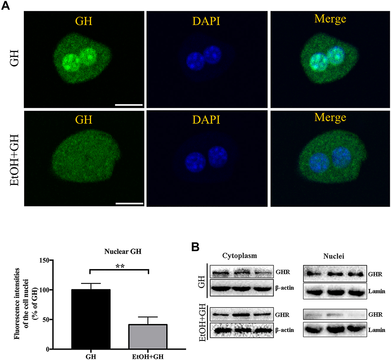 Figure 3: 
The impact of EtOH on the nuclear localization of GH in mouse hepatocytes. (A) The cells were exposed to alexa fluor 488-GH (20 μg/mL) for 30min, or exposed to alexa fluor 488-GH (20 μg/mL) after EtOH (1 %  v/v) treated for 30min. After washing, the cells were fixed and  stained with DAPI  (nucleus). The cells were subjected to CLSM. Bar=10 μm **p<0.01 compared with the GH group. (B) The expression of GHR in the membrane and nuclei of mouse hepatocytes. The cells were exposed to GH (20 μg/mL) for 30 min, or exposed to GH (20 μg/mL) after EtOH (1 % v/v) treated for 30min, the expression levels of GHR protein in the membrane and nuclei were detected by western blot. The figures shown represent at least three separate experiments.

