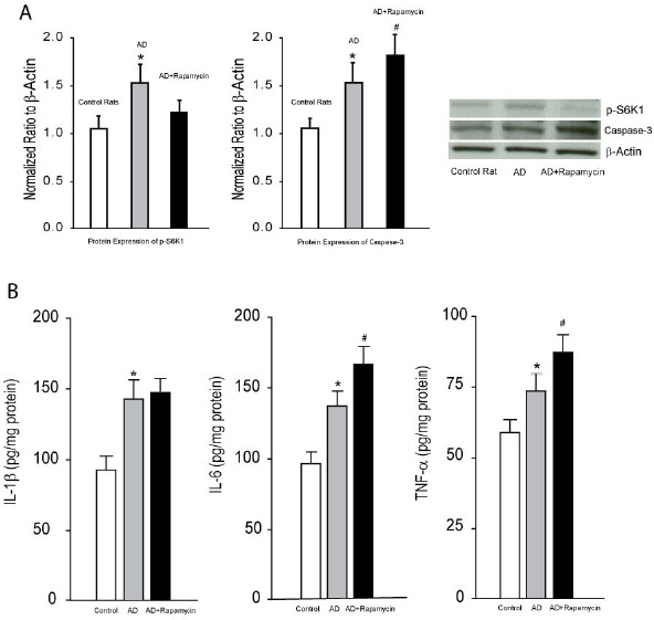 Figure 2 A. Averaged data (left panel) and typical bands (right panel) show that p-S6K and caspase-3 were increased in the hippocampus of AD rats as compared with control rats. Furthermore, infusion of rapamycin attenuated increases of p-S6K and amplified increases of caspase-3 in AD animals. *P < 0.05 vs. control rats and AD rats with rapamycin for p-S6K; and vs. control rats for caspase-3. #P < 0.05 vs. AD rats; n = 6-10 in each group. B. The levels of IL-1 β, IL-6 and TNF-α were amplified in the hippocampal tissues of AD rats. Inhibition of mTOR signal with infusion of rapamycin augmented increases of IL-6 and TNF-α in AD rats, but failed to affect IL-1β. *P < 0.05, AD rats (n = 20) vs. control rats (n = 15); and #P < 0.05, AD rats with rapamycin (n = 18) vs. AD rats (n = 20).