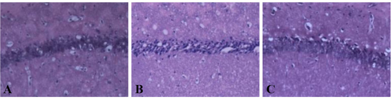 Figure 2 Hematoxylin-eosin staining of the CA1 region in hippocampus of (A) WT-CON; (B) WT-SAH; and (C) KO-SAH group. The HE staining displayed pyknotic nuclei and aggregate of nerve cells, suggesting cell damage. Figure B shows prominent nuclear condensation, the pyknotic nuclei were darker in color, and with a smaller size.