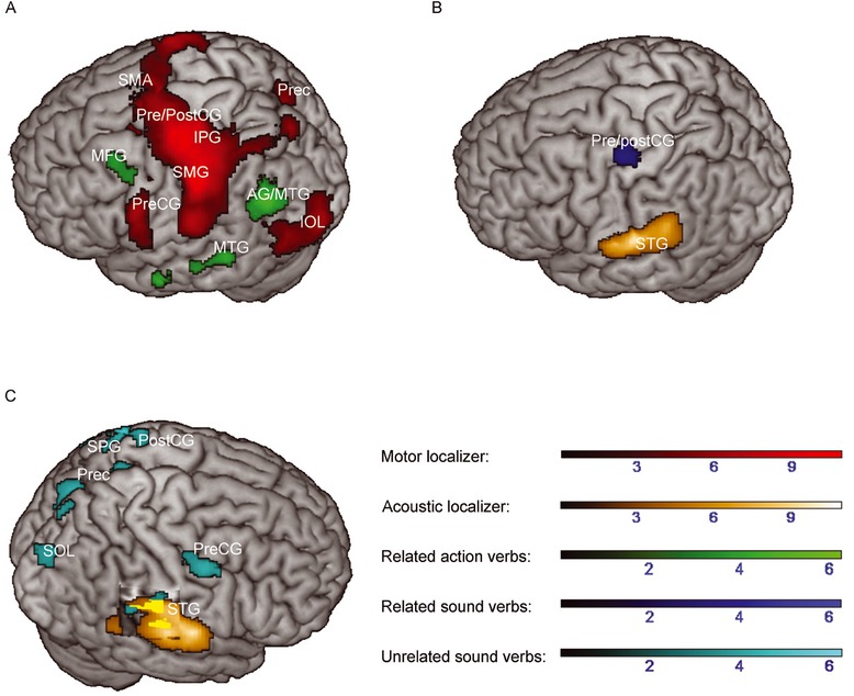Figure 2 Greater activation to related action versus sound verbs (A), related sound versus action verbs (B) and unrelated sound versus action verbs (C; main contrasts are depicted in green, blue or cyan respectively) during the context decision task overlaid with activations during the motor (red) or acoustic localizer (orange), respectively. Color range bars indicate T-scores. Activations below the surface are visualized by cutout. Cluster p was set to p < .05 (uncorrected) at the cluster-level. Results of the motor and acoustic localizer are reported at p < .05 FWE-corrected at the cluster-level. AG = Angular gyrus; IOL = Inferior occipital lobe; IPG = Inferior parietal gyrus; MFG = Middle frontal gyrus; MTG = Middle temporal gyrus; Prec = Precuneus; Pre-/PostCG = Pre-/Postcentral gyrus; SMA = Supplementary Motor Area; SMG = Supramarginal gyrus; SOL = Superior occipital lobe; SPG = Superior parietal gyrus; STG = Superior temporal gyrus.