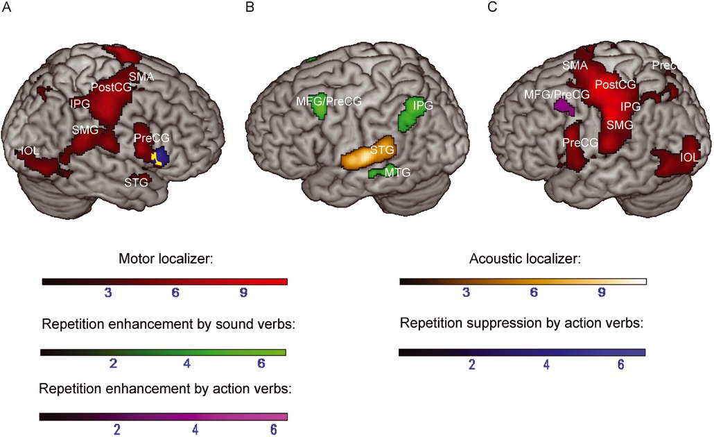 Figure 4 (A) Greater activation to new versus repeated action verbs (blue) (repetition suppression induced by action verbs) overlaid with activations during the motor localizer (red). (B) Greater activations to repeated versus new sound verbs (green) (repetition enhancement induced by sound verbs) overlaid with activations during the acoustic localizer (orange). (C) Greater activations to repeated versus new action verbs (violet) (repetition enhancement induced by action verbs) overlaid with activations during the motor localizer. Color range bars indicate T-scores. Overlapping activations are colored in yellow. Repetition suppression/enhancement effects are reported at p < .05 (uncorrected) at the cluster level and results of the motor and acoustic localizer are reported at p < .05 (FWE-corrected) at the cluster-level. IOL = Inferior occipital lobe; IPG = Inferior parietal gyrus; MFG = Middle frontal gyrus; MTG = Middle temporal gyrus; Prec = Precuneus; Pre-/PostCG = Pre-/Postcentral gyrus; SMA = Supplementary Motor Area; SMG = Supramarginal gyrus; SPG = Superior parietal gyrus; STG = Superior temporal gyrus.