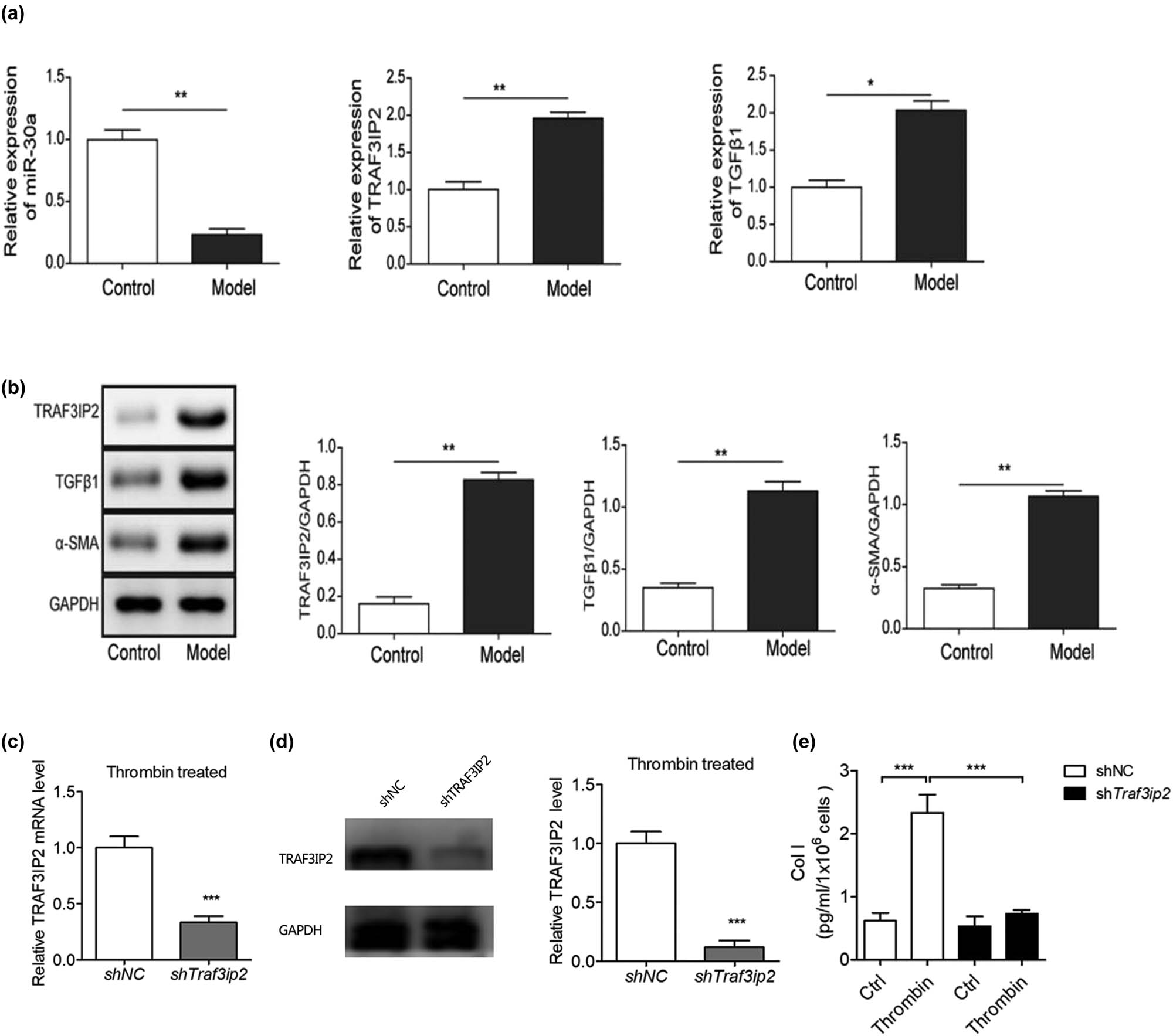 Figure 3 
            TRAF3IP2 activates AP-1 which promotes arachnoid fibrosis. (a) Differential mRNA expression of miR-30a, TRAF3IP2, and TGF-β1 between PHH rats and control rats (**P < 0.01 compared with the control group; *P < 0.05 compared with the control group). (b) Differential protein expression of TRAF3IP2, TGF-β1, and α-SMA between PHH rats and control rats (*P < 0.05 compared with the control group). (c) Decreased expression of TRAF3IP2 mRNA after transfected with TRAF3IP2 shRNA lentivirus (***P < 0.001compared with the control group). (d) Silenced expression of TRAF3IP2 protein after transfected with TRAF3IP2 shRNA lentivirus (***P < 0.001 compared with the control group). (e) Content of Collagen I in the primary arachnoid cells, which were transfected with TRAF3IP2 shRNA lentivirus for 48 h and treated with 10 U/mL thrombin for 4 h (***P < 0.001 compared with the control group).
          