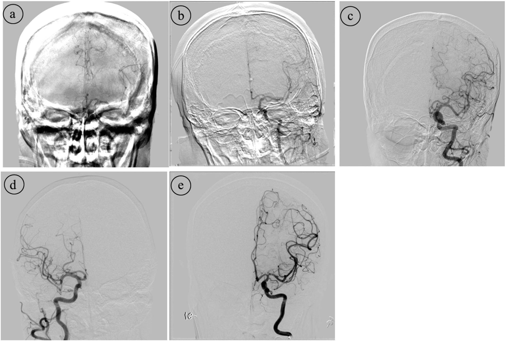 Figure 2
DSA image quality score with picture illustration.