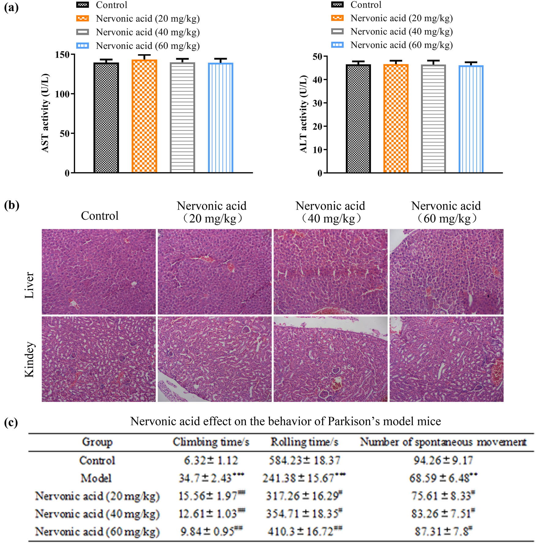 Figure 1
NA displayed no toxicity on mouse liver and kidney. (a) Mice were treated with indicated doses of NA; serum levels of AST and ALT were detected. (b) Representative H&E images of livers and kidneys from mice treated by NA at different concentrations.