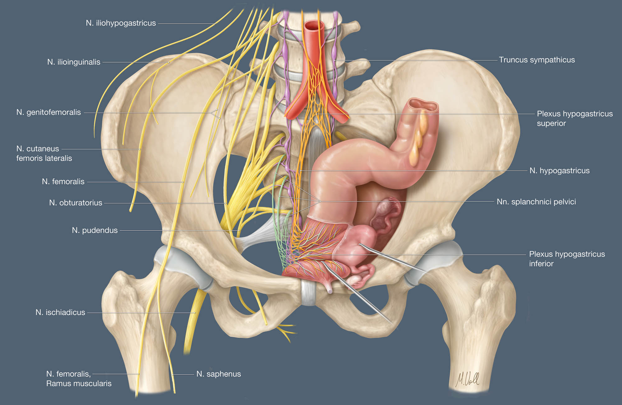 Figure 6 
               Anatomical illustration of somatic and autonomic pelvic nerves in a female pelvis (frontal view). Yellow – somatic nerves, orange – sympathetic plexus, purple – sympathetic trunk, green – PSN.
            