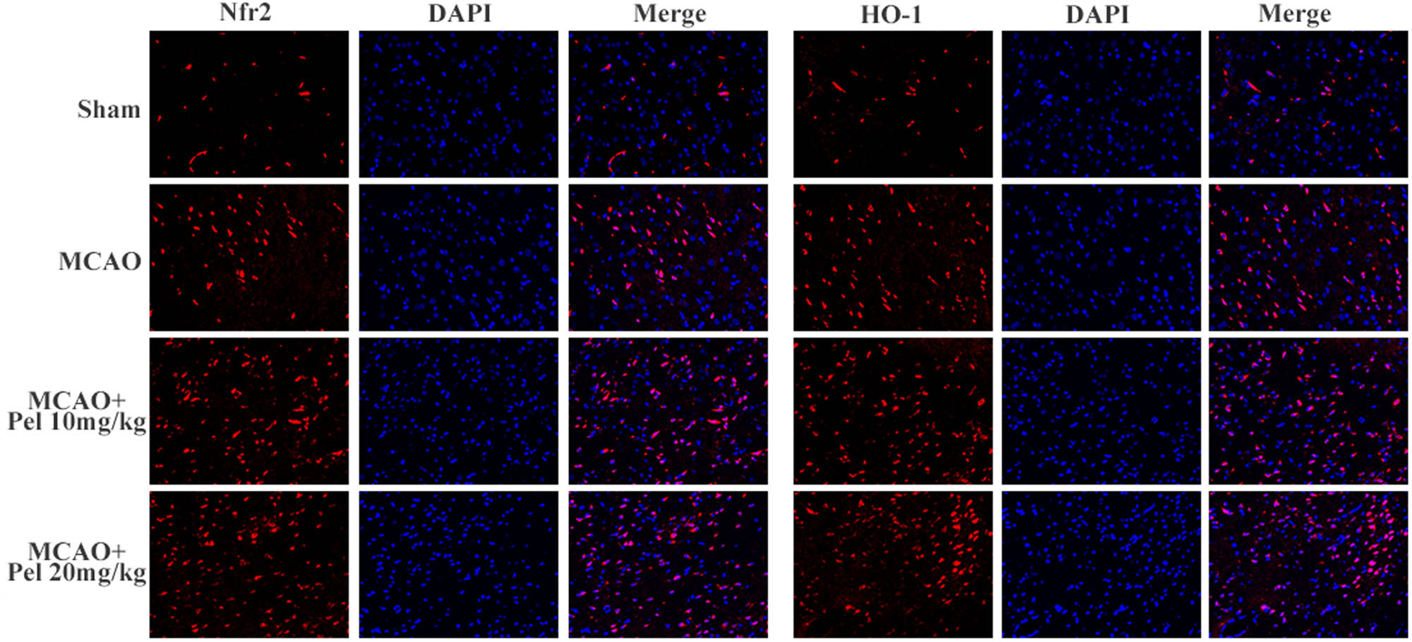 Figure 6 
                     Immunofluorescence was used to observe the expression of Nrf2 and HO-1 in the brain tissues of rats in each group (scale bar = 100 μm).
                  