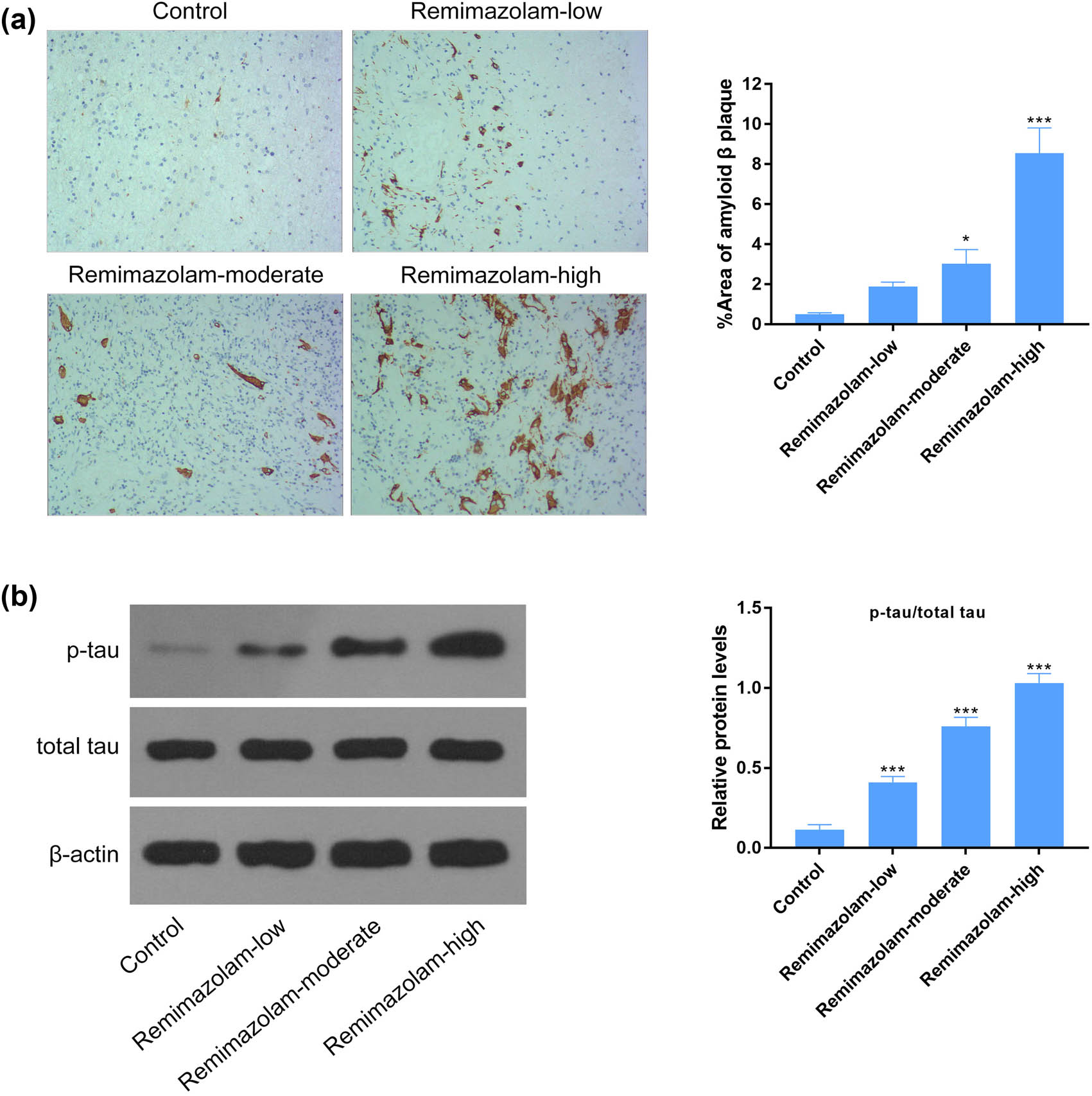 Figure 2 
                  Remimazolam mediated hyper-phosphorylation of tau proteins in mouse brain. (a) Significant depositions of amyloid β plaque in remimazolam treated mice group assessed by immunohistochemistry. (b) Remimazolam significantly induced the activation of tau protein and phosphorylated tau in mouse brain, compared to control. Right panel shows the quantifications. Quantifications of protein levels. Experiments (n = 3). Data represent mean ± SEM. *P < 0.05, **P < 0.01, ***P < 0.001.
               