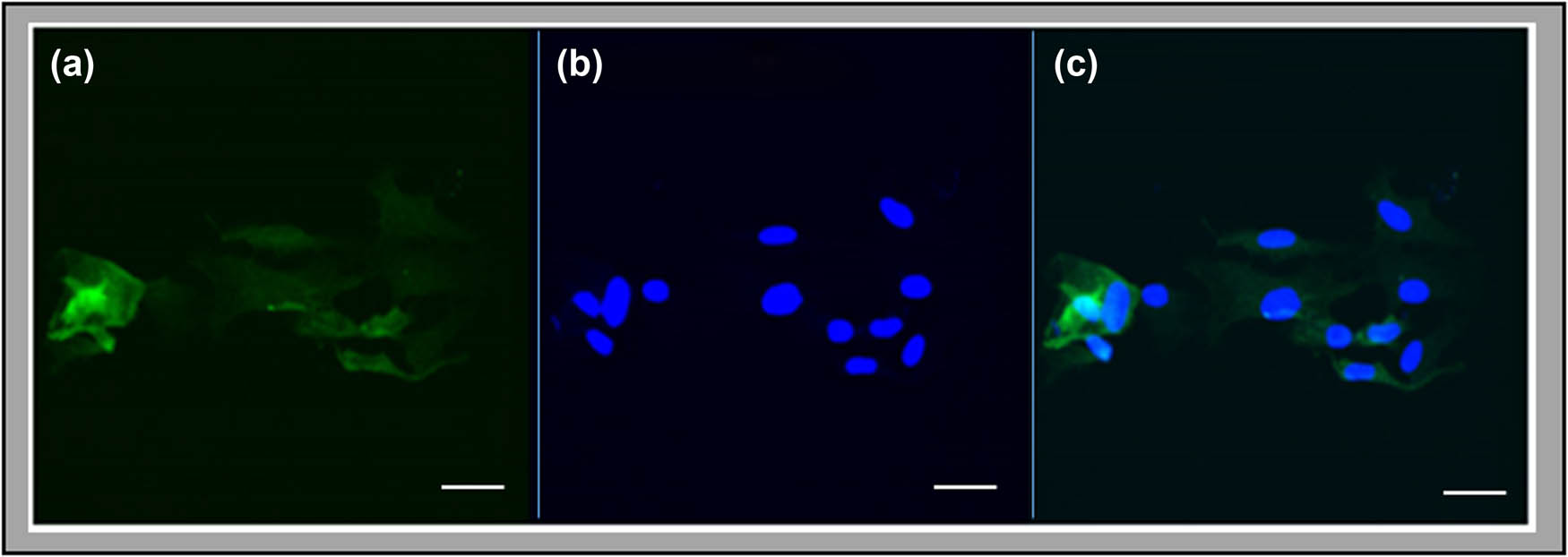 Figure 1 
                  Immunofluorescence staining of hypothalamic primary astrocyte cell cultures for the astrocyte-specific marker GFAP. Cultured astrocytes were immunostained for cytoplasmic GFAP immunoreactivity (left-hand panel (a) green fluorescence) and exposed to the DNA stain DAPI (middle panel (b) blue fluorescence), and imaged with a Zeiss LSM 5 PASCAL confocal scanning laser microscope. The right-hand panel in (c) shows a merged image of these staining patterns. Scale bar = 50 μm.
               
